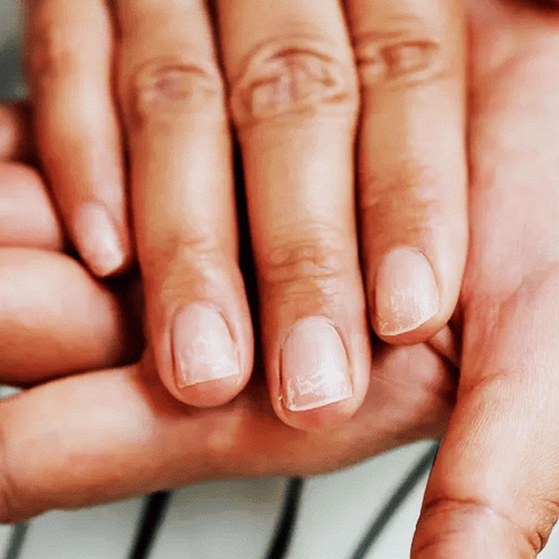Osłabione i łamliwe paznokcie to częsty problem wielu kobiet. Poznaj skuteczne sposoby na wzmacnianie i regenerację paznokci, aby były zdrowe i mocne każdego dnia.