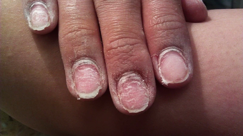 Osłabione, cienkie lub rozdwajające się paznokcie po hybrydzie można odbudować w domu. Poznaj metody, które przywracają płytce siłę, elastyczność i naturalny połysk.