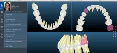 цифрова ортодонтія у стоматології
