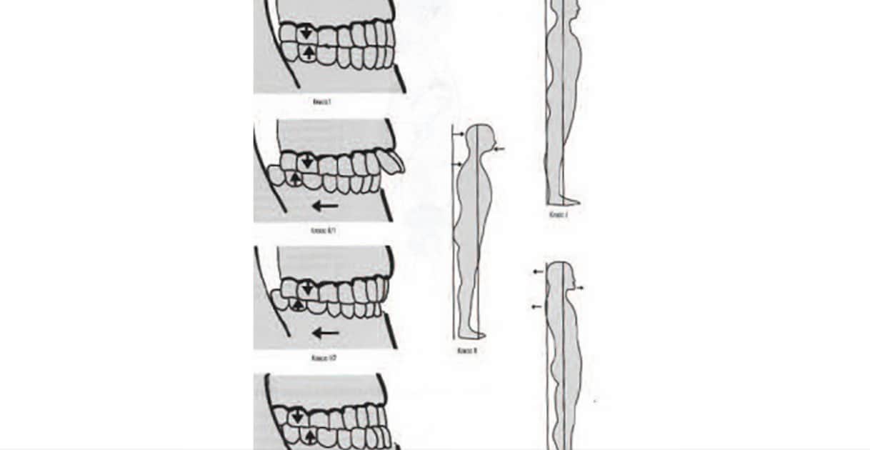 Гнатолог у стоматології АССА