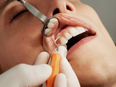 Симптомы после удаления зуба мудрости
