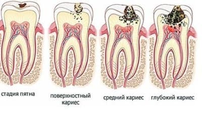 Стоматология асса и лечение зубов