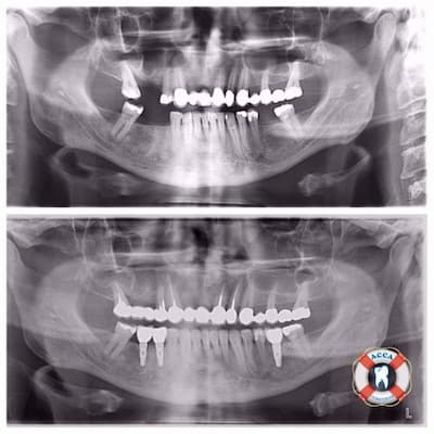 Панорамний знімок зубів у стоматології АССА