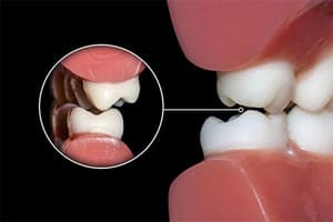 Гнатологія-лікування у стоматології АССА