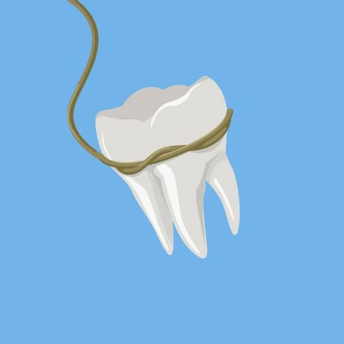 Удаление зуба противопоказания